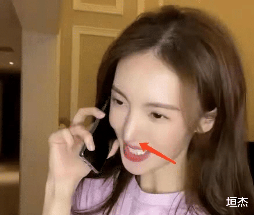 医美|一脸科技感、鼻子一捏就塌,“过度医美”的女星们,各有各的心酸