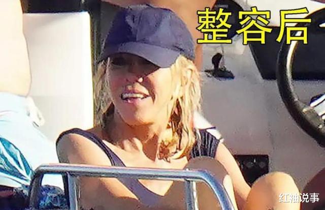 运动 69岁布丽吉特爱折腾，接受整容瞬间变漂亮，每年美容费高达百万