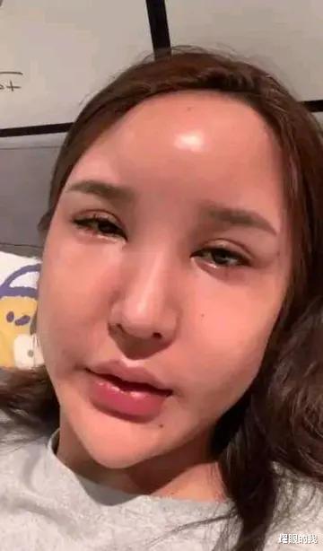 高明远|网红整容有多离谱？韩安冉医生建议灌水泥，最后一位死在了手术台