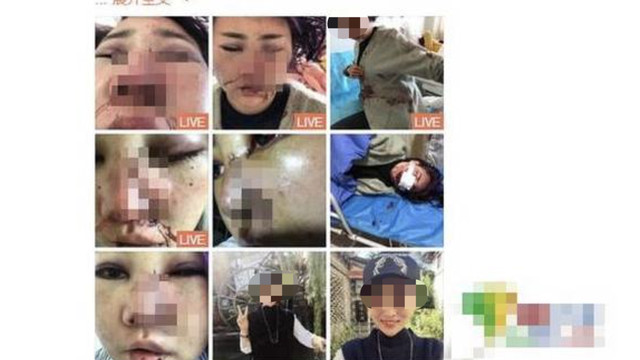 “轻伤不轻，重伤很重”，轻伤二级惹网友争议