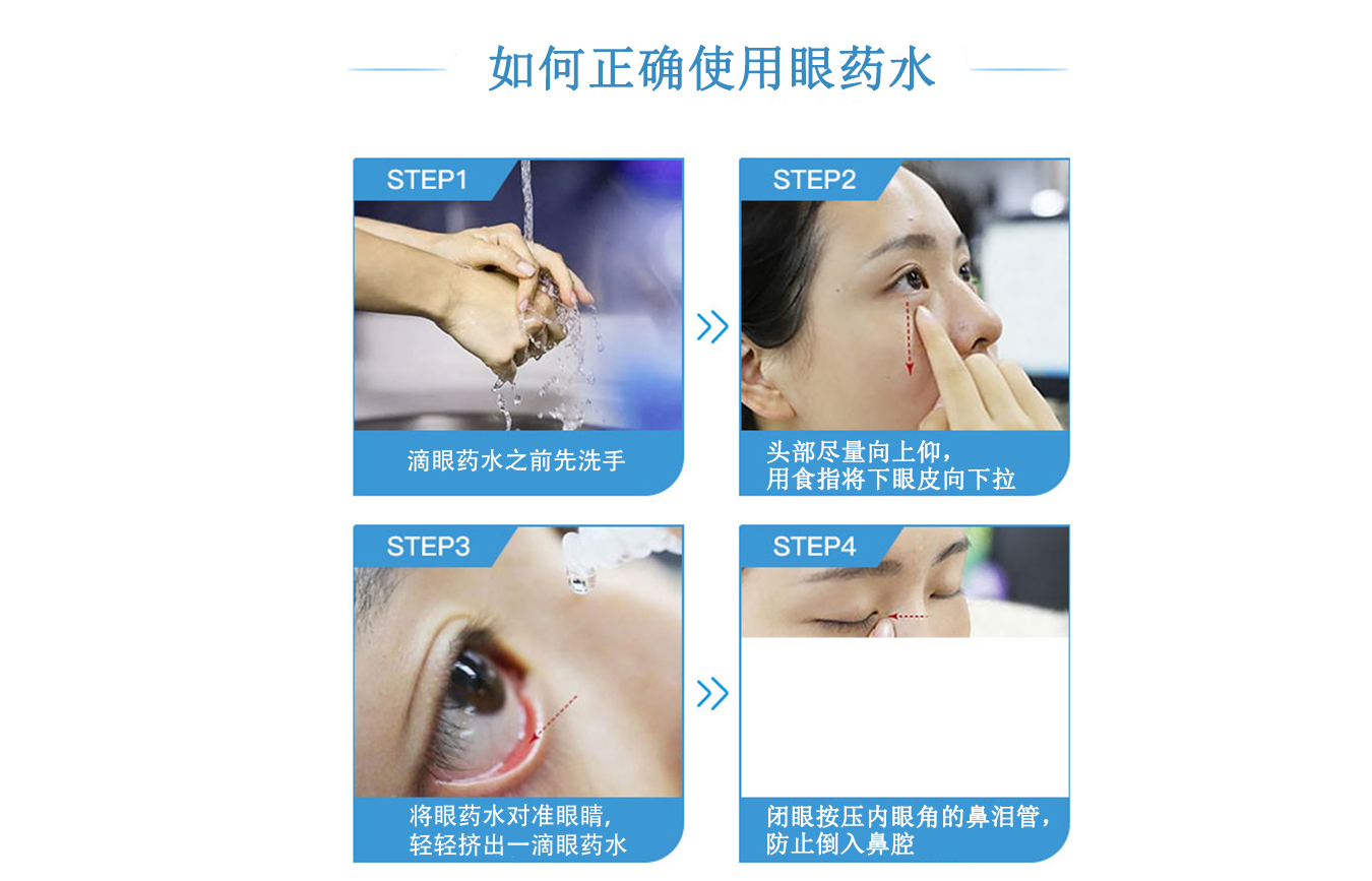 近视|阿托品滴眼液治疗儿童近视:最佳浓度及与其他方案联合使用