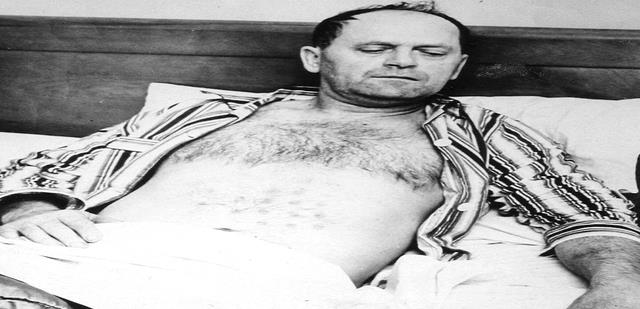 加拿大男子曾近距离触摸UFO,身上出现神秘图案,究竟怎么回事?