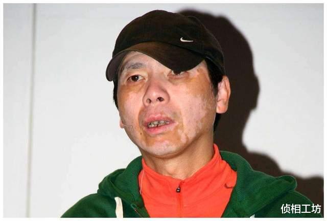 冯小刚|被疾病缠身的明星们,周杰伦患病变胖,冯小刚亿万身家放弃治疗?