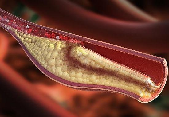 中药|它是血管“清洁工”,每天坚持吃点,有助疏通血管,预防“血栓”