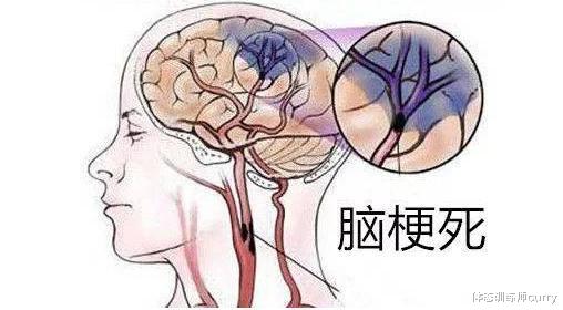 脑梗|49岁女子很少吃肉,却意外脑梗,医生坦言:3种素食最好少吃