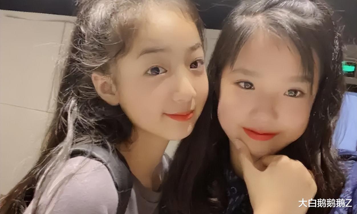 钟丽缇|钟丽缇女儿被质疑整容！考拉上线维护：你们家小孩14岁就整容了？