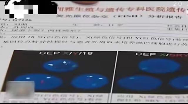 母亲怀孕吃打胎药,致使双胞胎儿子变成双胞胎女儿
