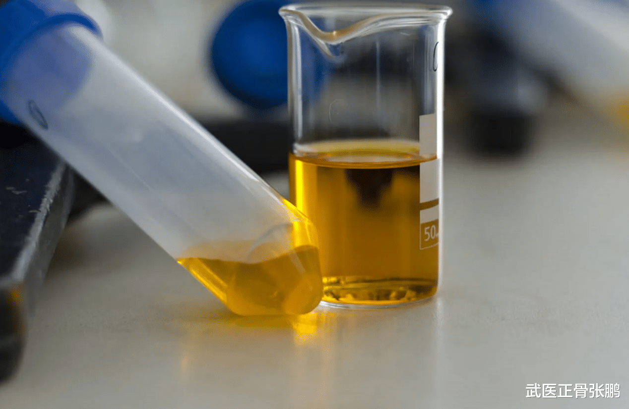 面条|肾衰并非悄无声息,内科医生:睡觉若有3种异样,多半是肾“扛不住”了