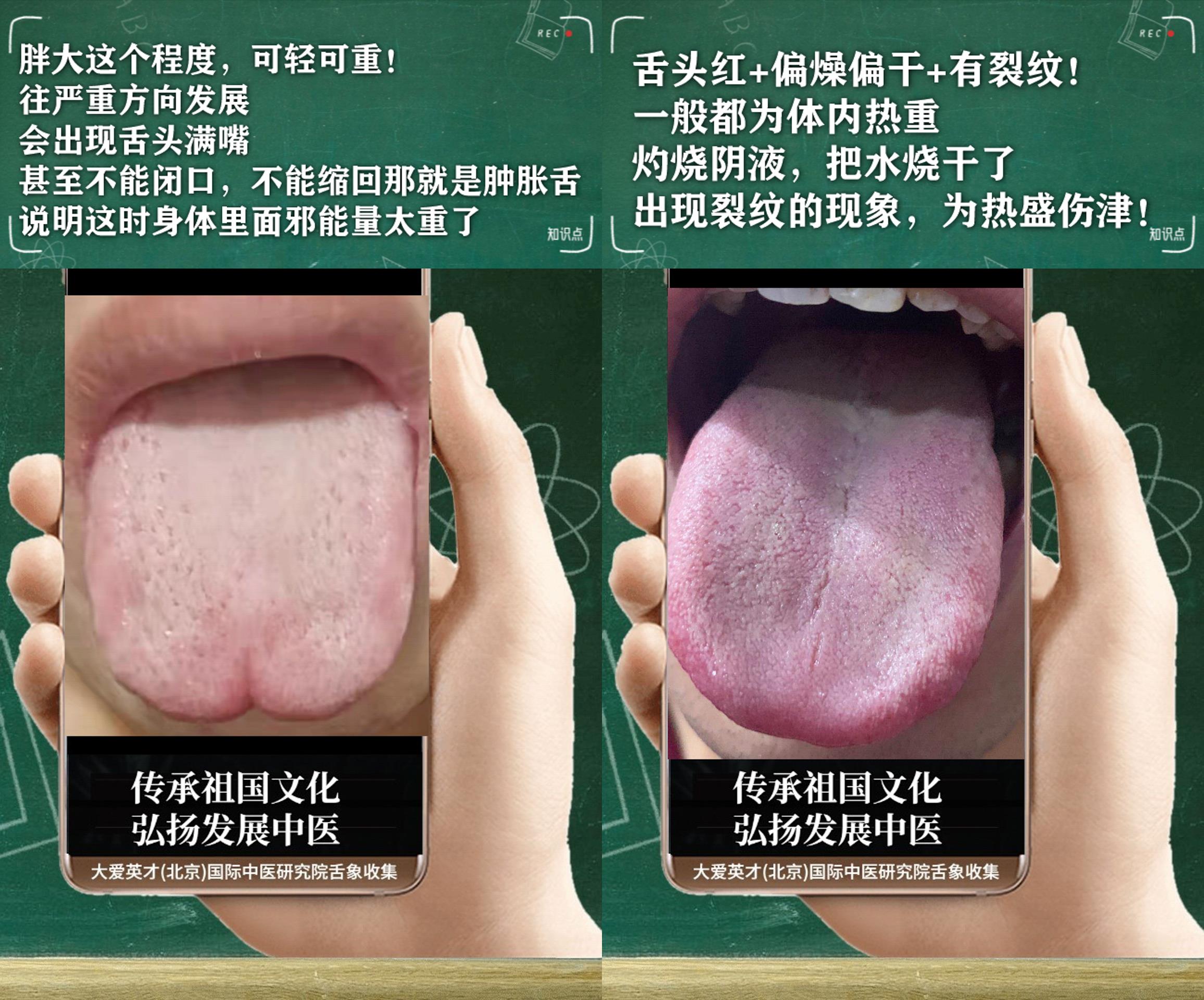 医学|中医病症：内心不安、头晕目眩、咳嗽气喘、经常复发非常绝望