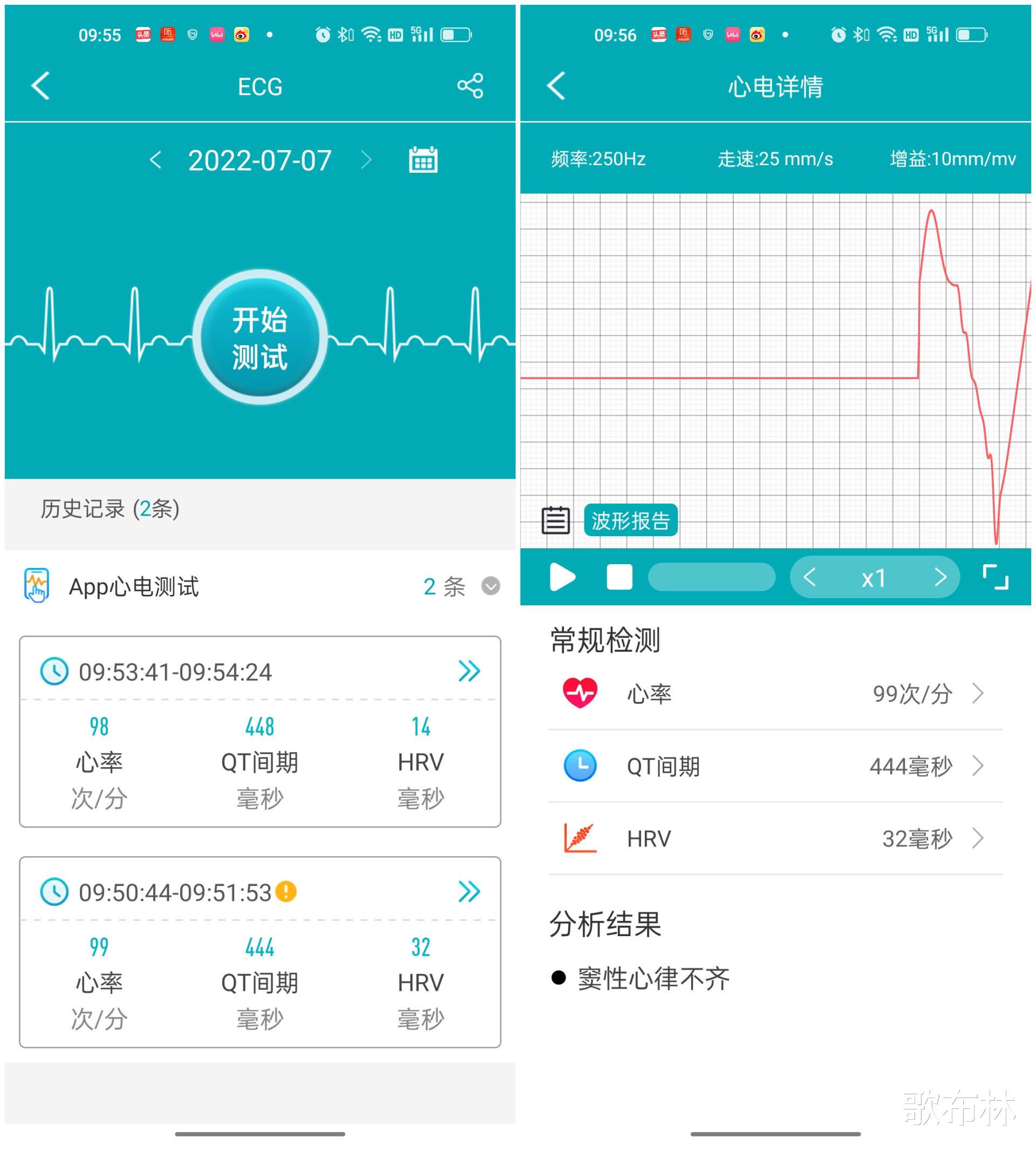 dido|血压心率一手掌控：dido Y1S智能手环评测