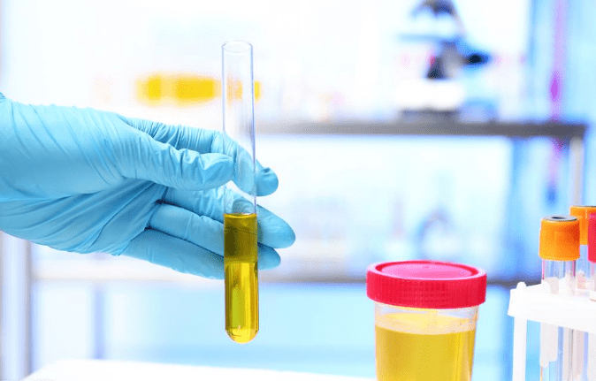 医生|肌酐7百多能吃药降下来吗？肾内科医生：控制好3点就能