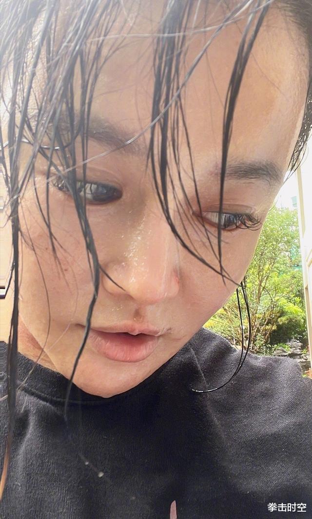 冉莹颖 痛心！冉莹颖为减肥身体出现变化，网友：姐姐你脖子上是怎么了