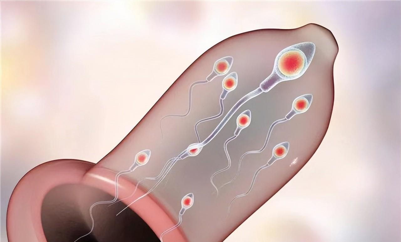 结扎|节育环一直不取出来,会长到肉里吗?在多大年龄之前取出比较好?