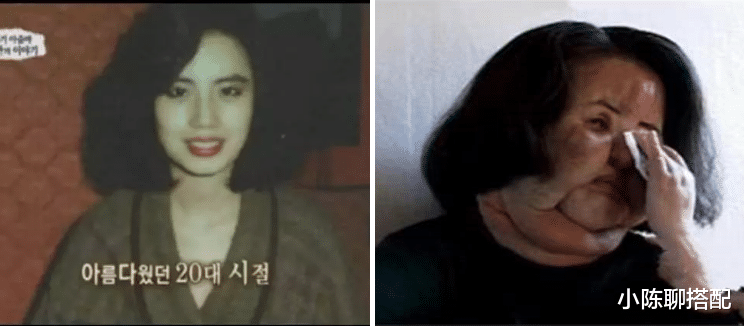 整容|“整容上瘾”的韩慧景:从眉清目秀到电扇脸,付出惨痛代价