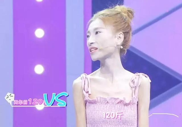 祛斑 从120到58,行走的“骷髅妹”为爱瘦身:那些被减肥毁掉的女孩们。