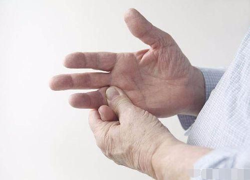 疾病|早上醒来双手发胀,握不拢,几分钟后又恢复正常,这是什么情况?