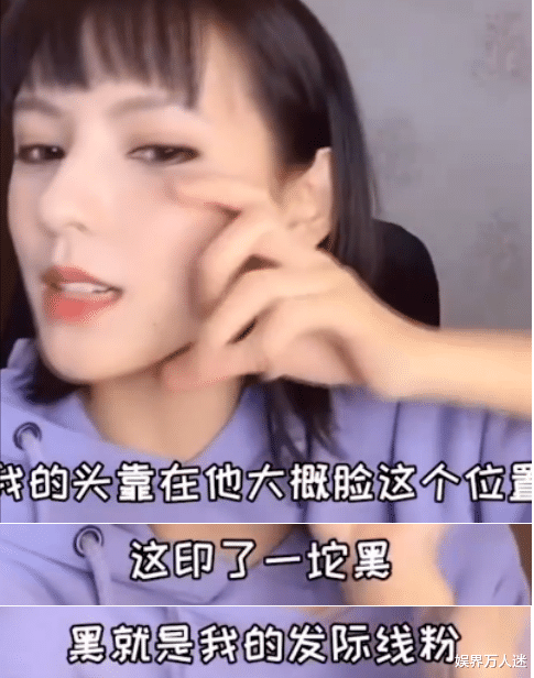 发际线|明星奇葩发际线大赏，华晨宇像机器缝的，有人半个额头都是胎毛