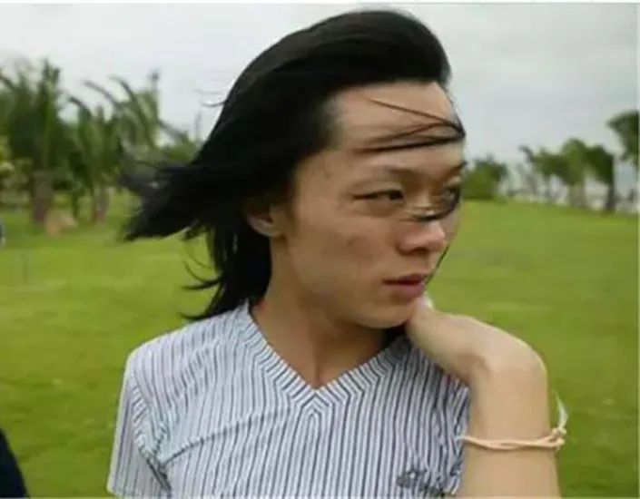 “变性人”李二毛,被两任男友抛弃,摘除假体后因艾滋孤独离世!