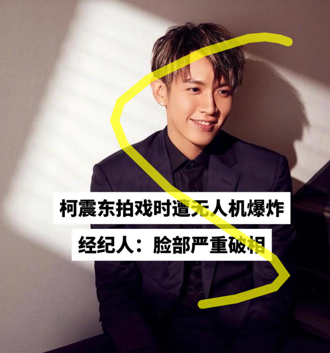 柯震东|柯震东面部毁容,缝了30针自称不敢面对,网友:有何脸面复出?