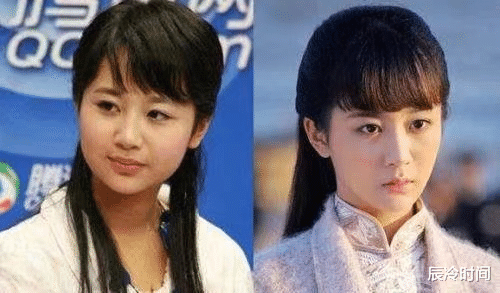 整容|娱乐圈整容已成常态,假鼻子、假脸型、假屁股,有的60岁还像少女