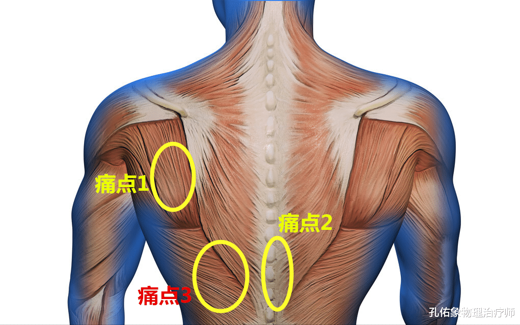 体检|肩胛区域及后背疼是咋回事?不出意外,这6种可能性最大