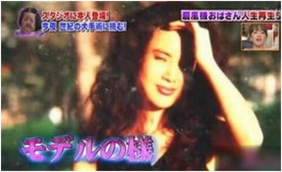 整容|7位被整容毁了的明星,有人美丽尽失事业滑坡,有人甚至赔了性命