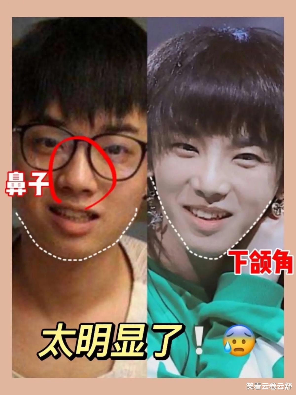 整容|有种倔强叫“我没整容”！明明从大饼脸变成了V脸，当观众瞎吗？