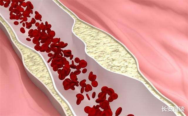 桑螵蛸|人到中年血液粘稠，莫慌！多吃此菜，血管畅通无阻，早吃早健康