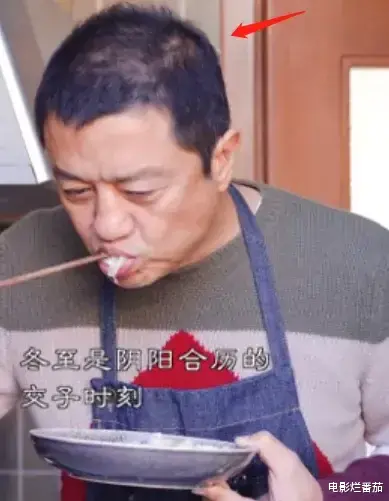 发际线|“秃顶”危机的10大男神，有人29岁发际线堪忧，有人常年戴假发套