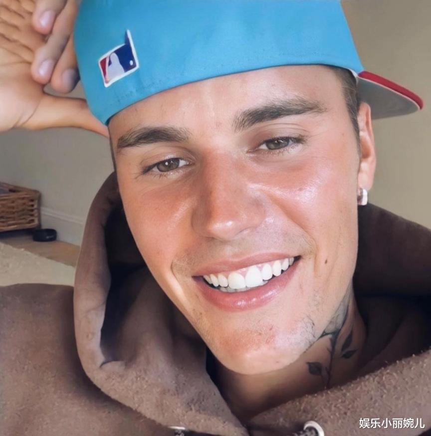 张若昀|贾斯汀·比伯罹患罕见神经性疾病，右脸瘫痪，取消演唱会