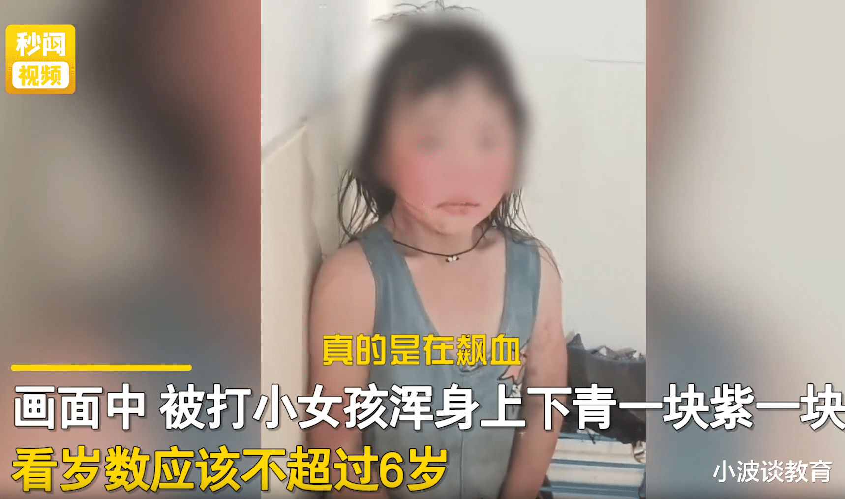小女孩被后妈殴打，打得遍体鳞伤，跑到邻居家躲避，更多细节曝光