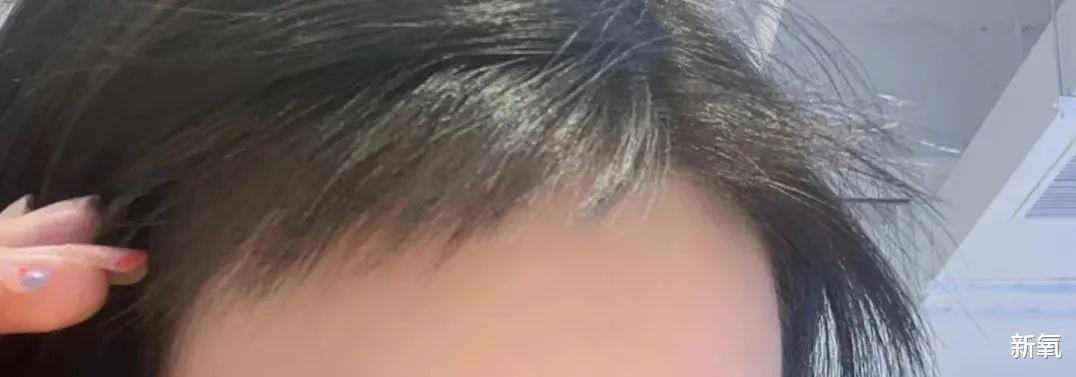 牛仔裤 为什么胎毛刘海时而油腻，时而显嫩？