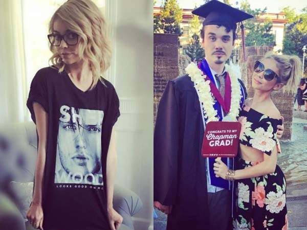 医生|16次手术、2次肾移植!这名女演员告诉我们:活着,才能看见光明