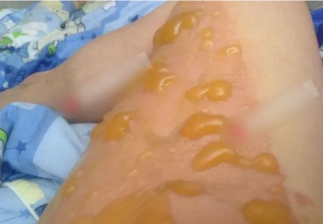 上海静安,一女子到朋友家吃火锅,不料前男友也在那里
