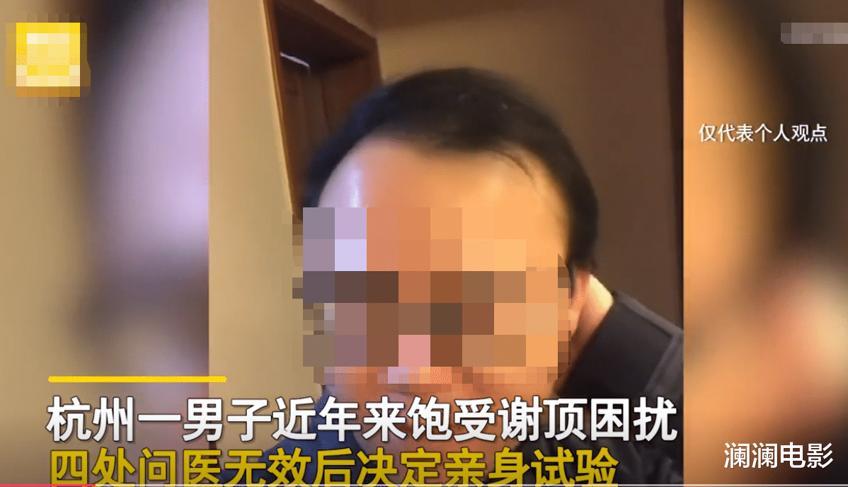 脱发|男子坚持半个月不用洗发水洗头,一照镜子自己乐了!