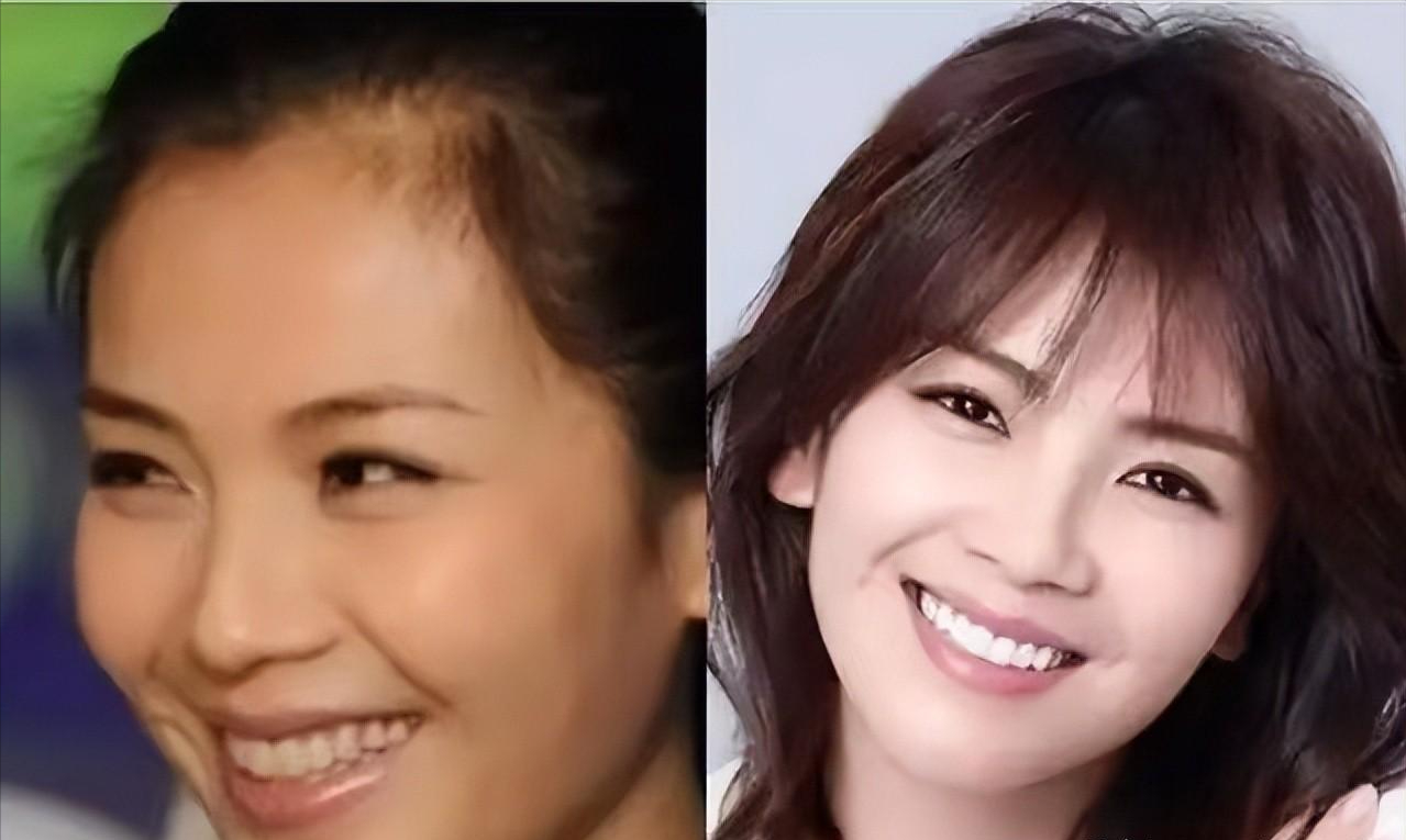 娱乐圈|假发假臀假肌肉，“从头假到脚”，还有什么是真的？