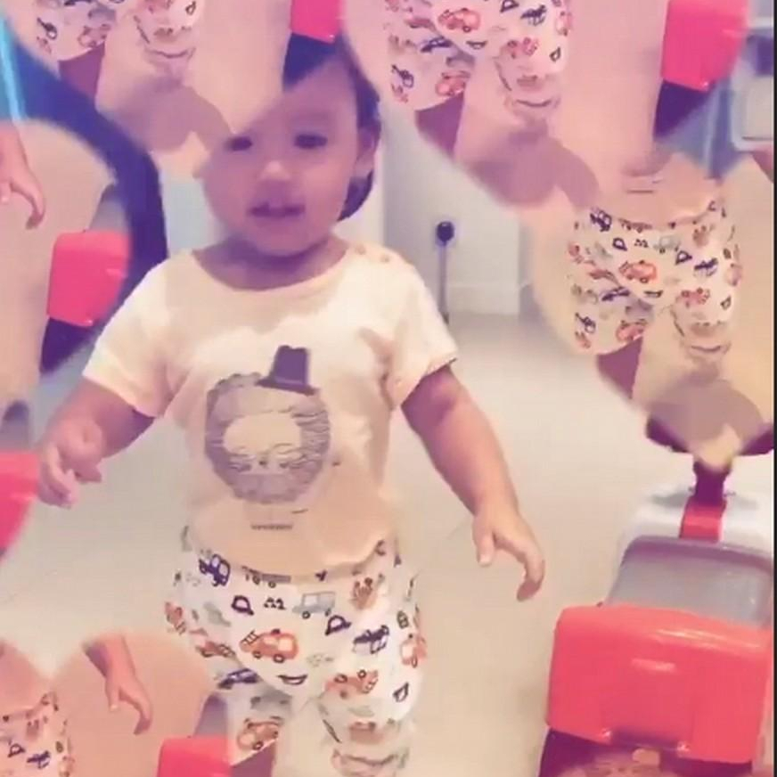 张柏芝|张柏芝被3岁小儿子抓伤脸部，伤口较长且深像刀疤一样遮都遮不住