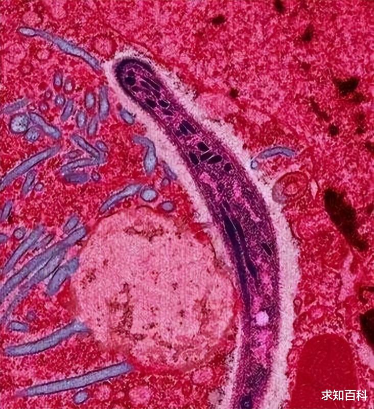 寒武纪以来的共生,钻进人类血管,你想不到的“物种宫斗大戏”