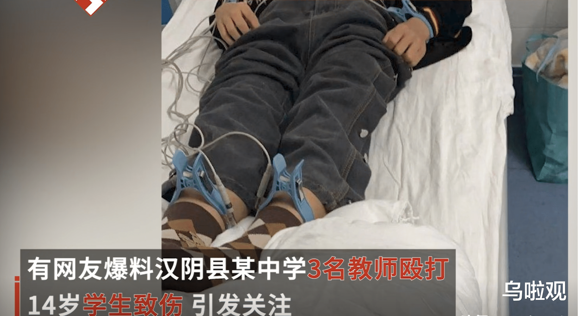 陕西安康3名体育老师操场围殴14岁学生,学生放学回家家长发现伤势,讨要说法却反被指责?
