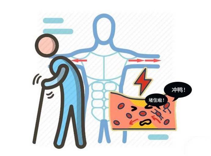 心肌梗塞|心血管不好的人,多少注意下饮食!3种食物最好别吃,避免心梗