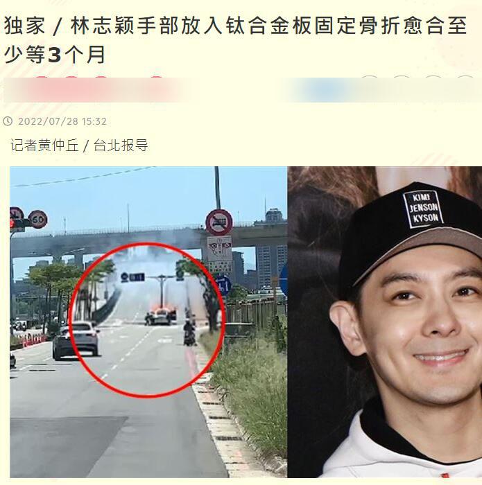 林志颖|曝林志颖第二场手术完成：手臂放钛合金固定，需等3个月才能愈合