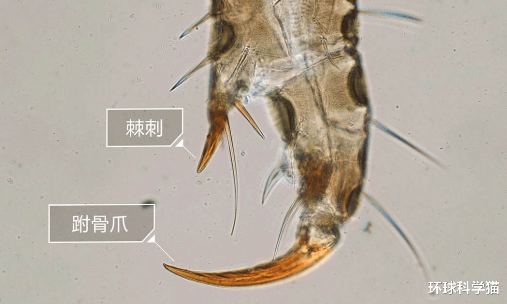 ?比人出现更早,活上千万年的虱子,30年前常见,为何如今难见到?