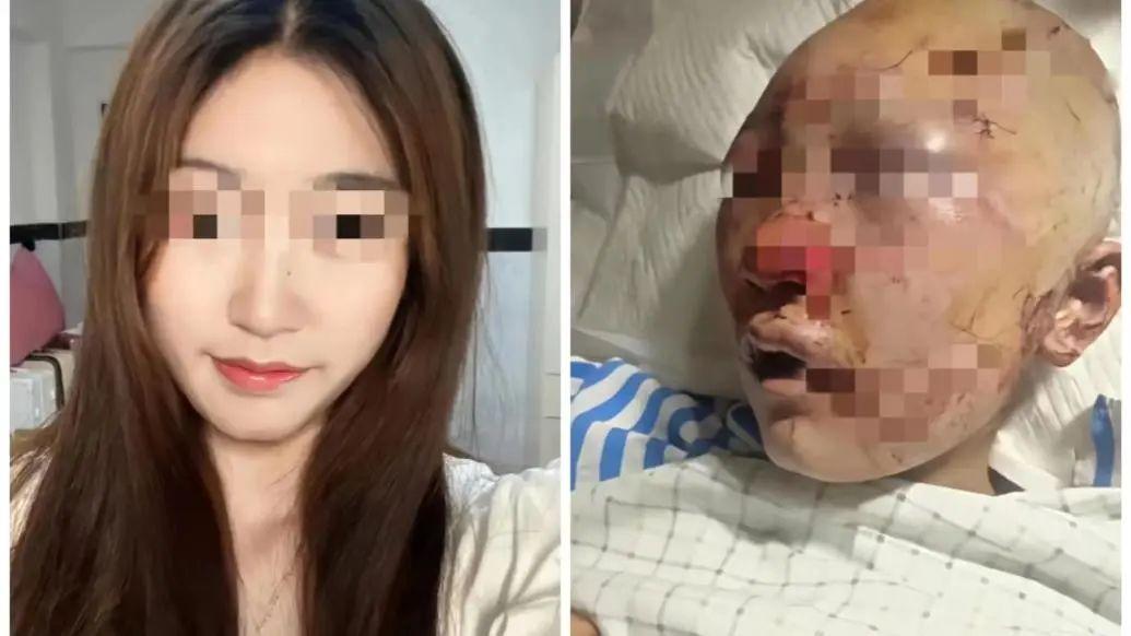 女孩上公厕被打,警方否认施暴男\精神不正常\