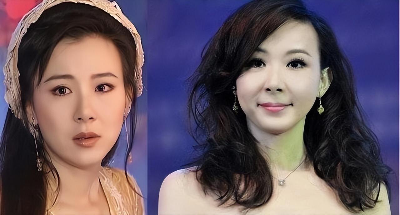 整容|脸垮得不能看，下巴能犁地？中年女明星微整后才是“重灾区”