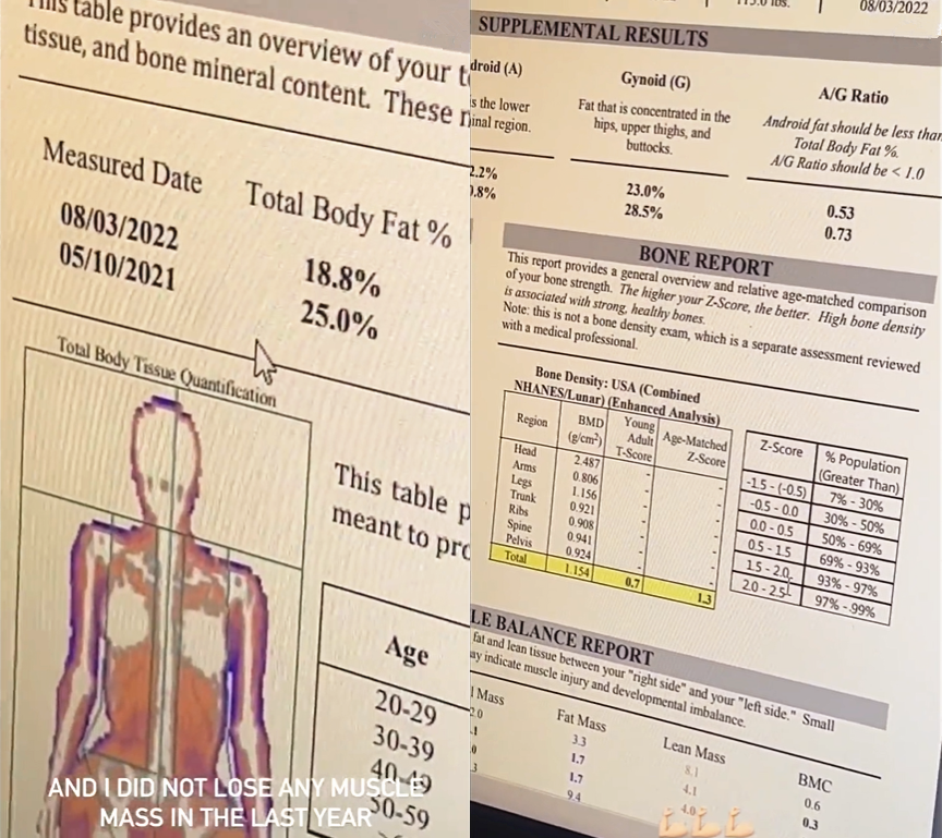佟丽娅|金卡戴珊晒体检报告！常年整形导致身体比例失调，骨盆比肩膀还宽