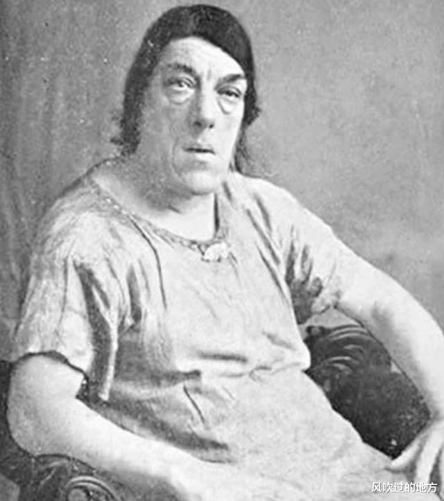 朱丽娅|她被称为世上最丑的女人，却被富豪娶走，死后被制成标本供人欣赏