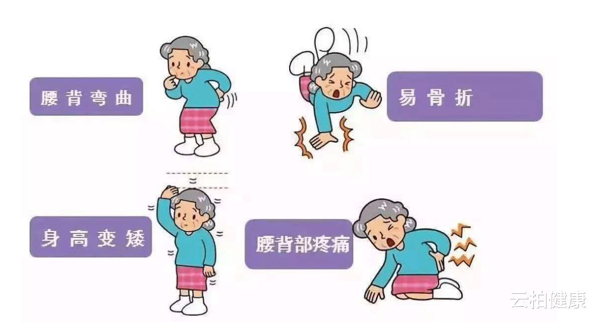 骨质疏松|骨质疏松越来越严重，日常坚持2件事，或能强健骨骼