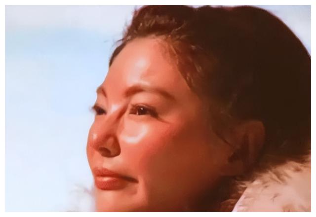 整容|张雨绮疑整容失败，满脸硅胶五官僵硬，侧面看像猪刚鬣