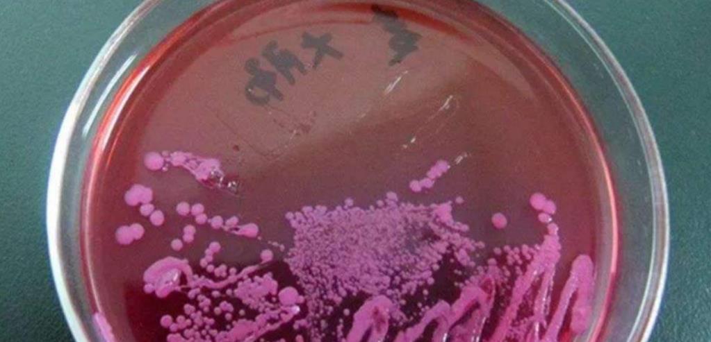 科学家为“永生”,与女模特一起注射350万年前细菌,后来怎样?
