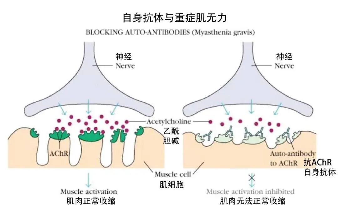 重症肌无力|每年29亿美元年销售额?一文解析治疗重症肌无力新药efgartigimod